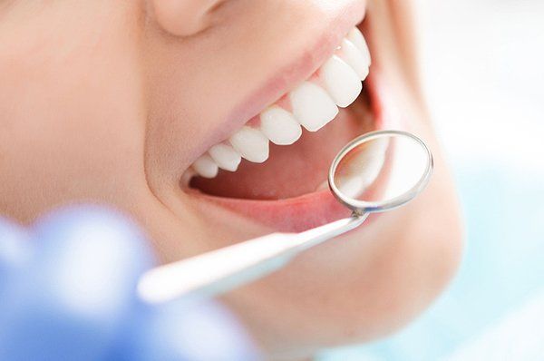 White teeth