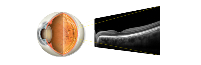 Eye exam service