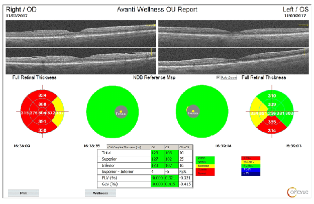 Avanti Wellness OU Report