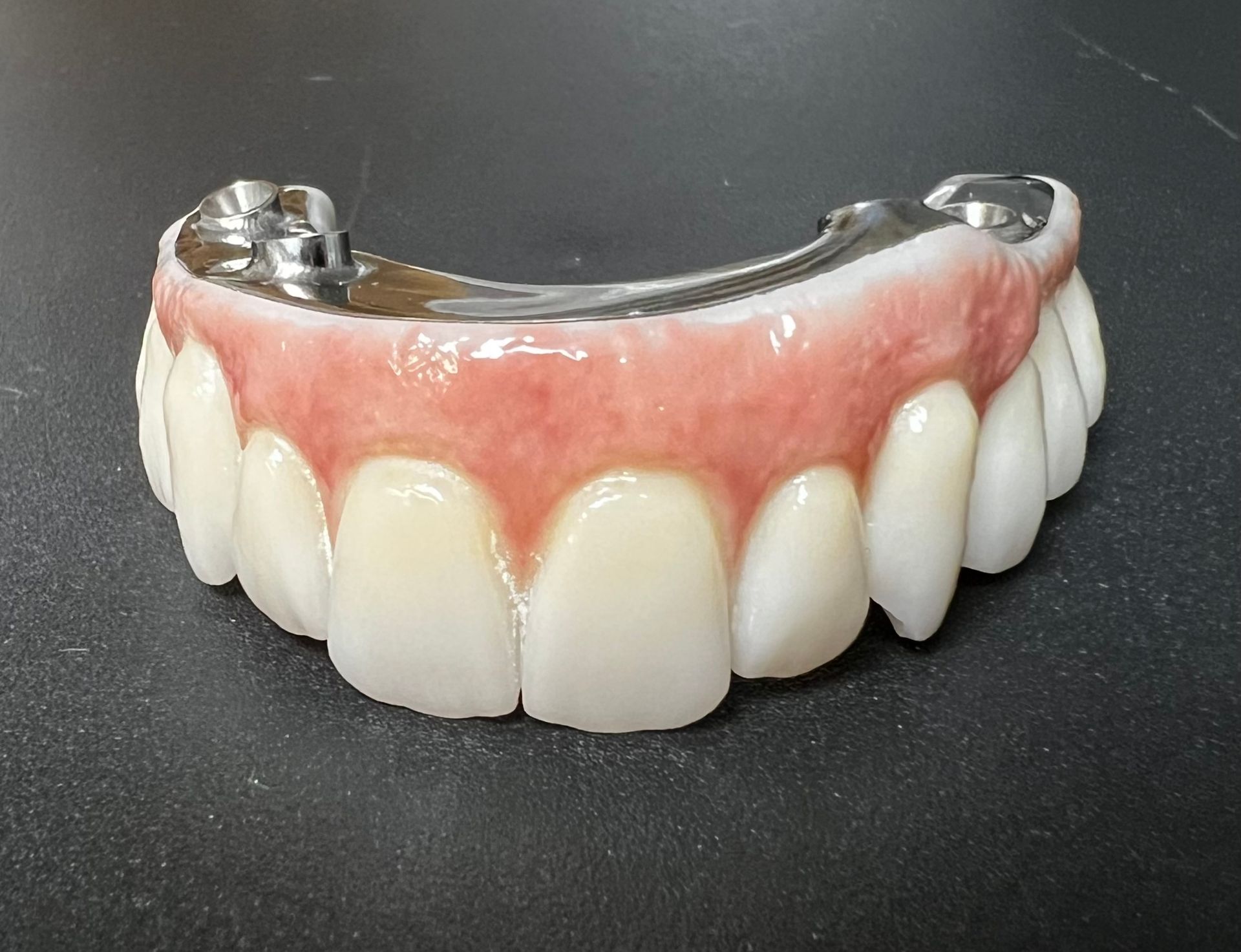 Partial dental prosthesis with pink gums and white teeth.