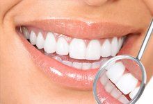 Sparkling white teeth