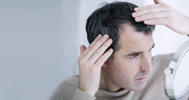 Man examining hairline in a mirror, grey hair visible, touching his head with both hands.