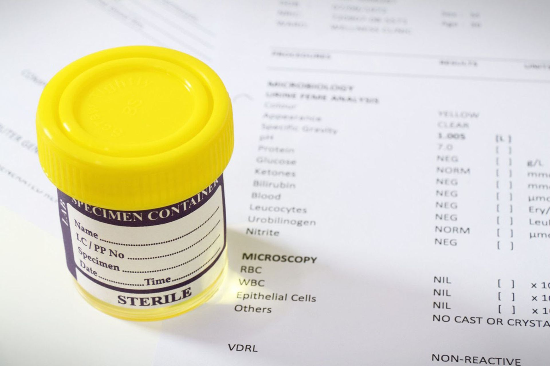A yellow jar of urine is sitting on top of a medical report