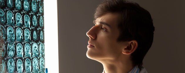 Checking brain X-Ray