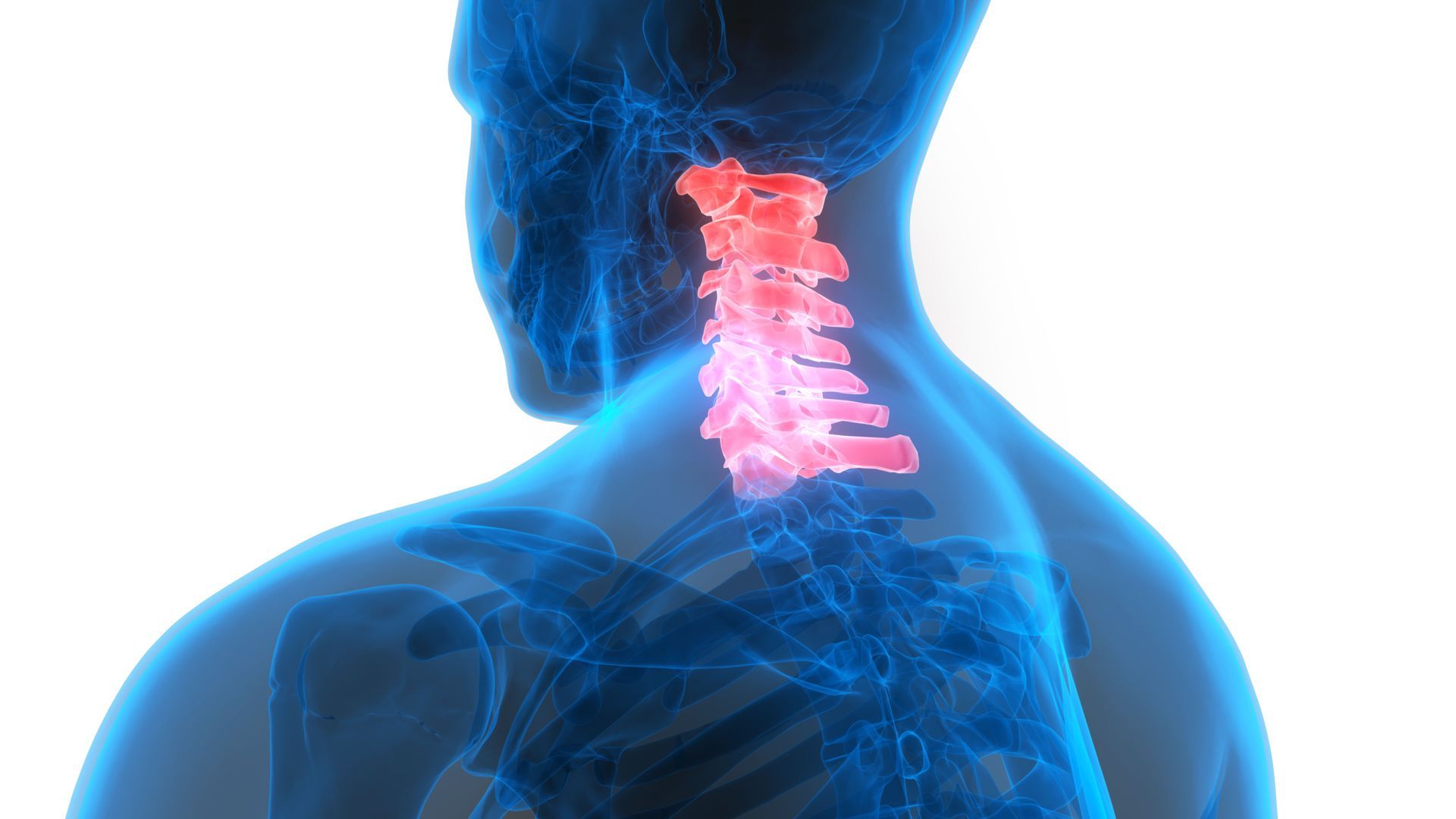 A see-through diagram of a person's shoulder, neck, and head highlighting the spine in the neck.