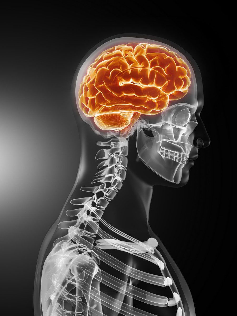 An X-ray of a human body with an orange brain.