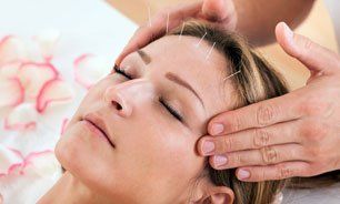 Acupuncture