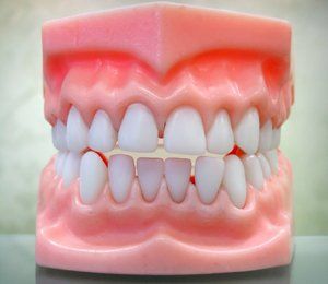 Dentures | Mid Florida Dental Assoc., Inc | 407-870-5004 | Kissimmee, FL