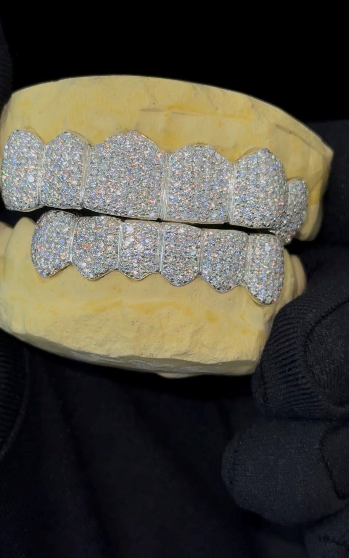 Silver diamond grillz displayed on a yellow dental mold, held with a black glove.