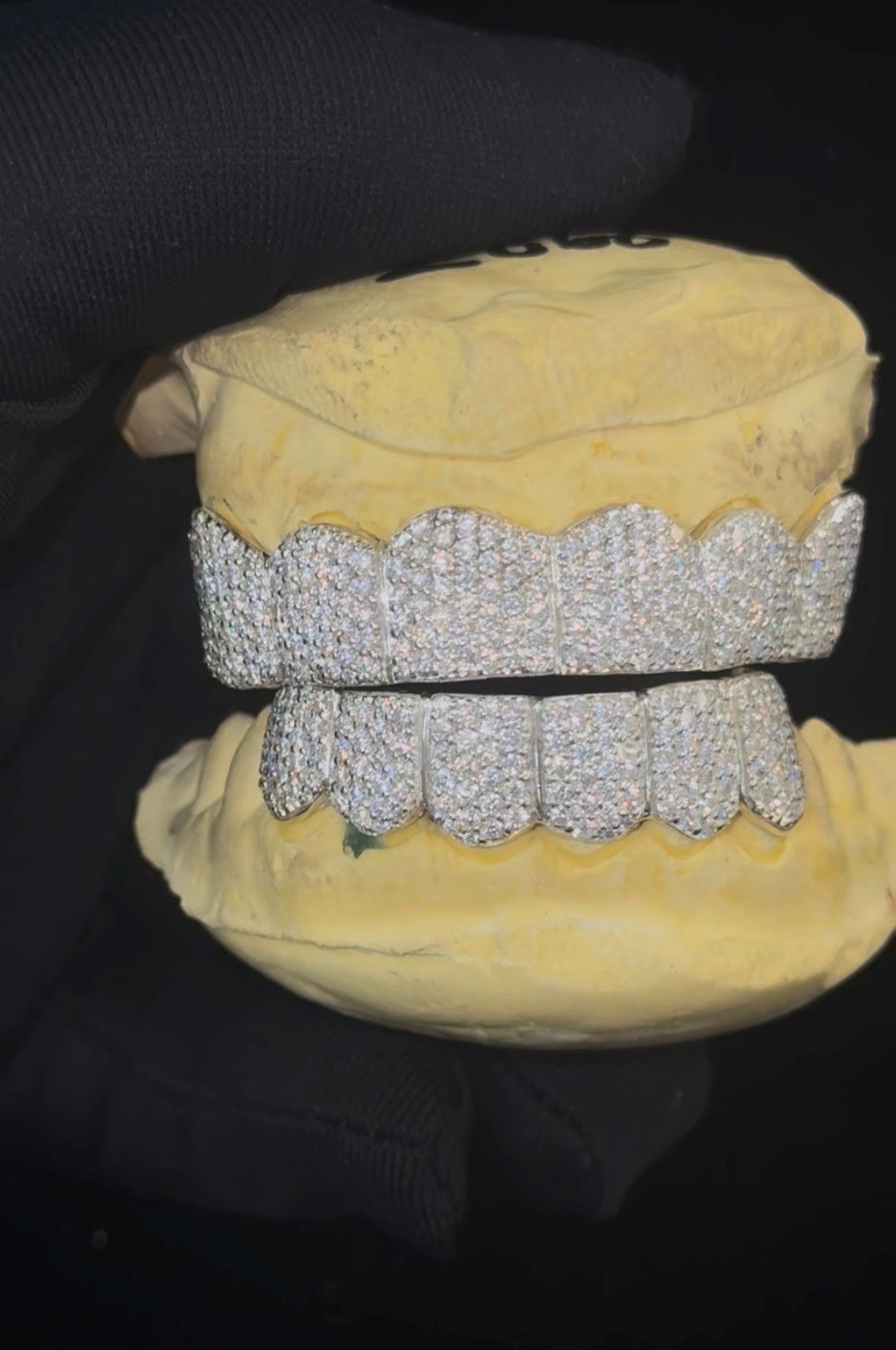 Dental model with upper and lower yellow gums and white teeth against a dark background