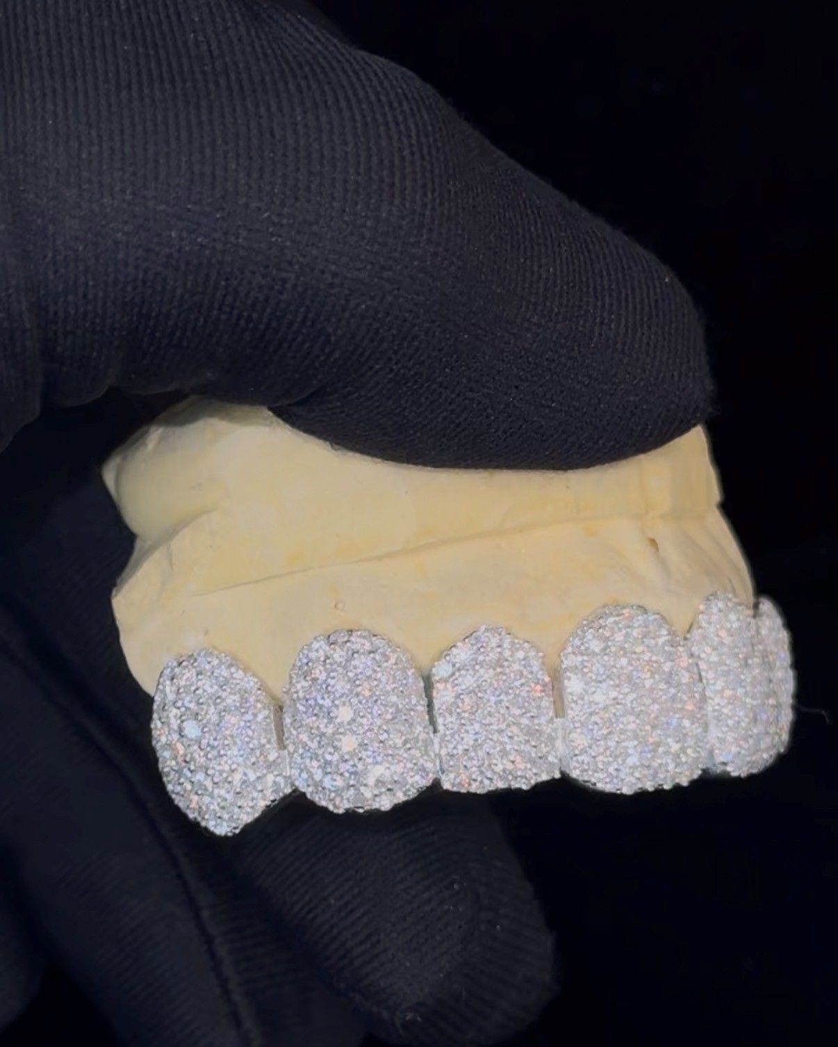 Close-up of a gloved hand holding a gold dental mold with five glittery silver teeth caps