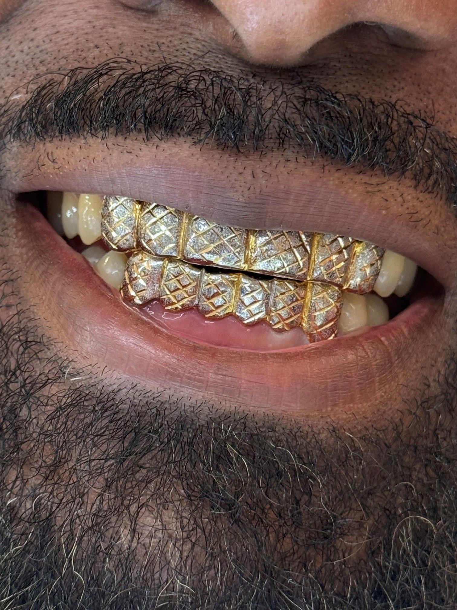 Close-up of a smiling mouth wearing gold, diamond-studded grills with a beard visible.