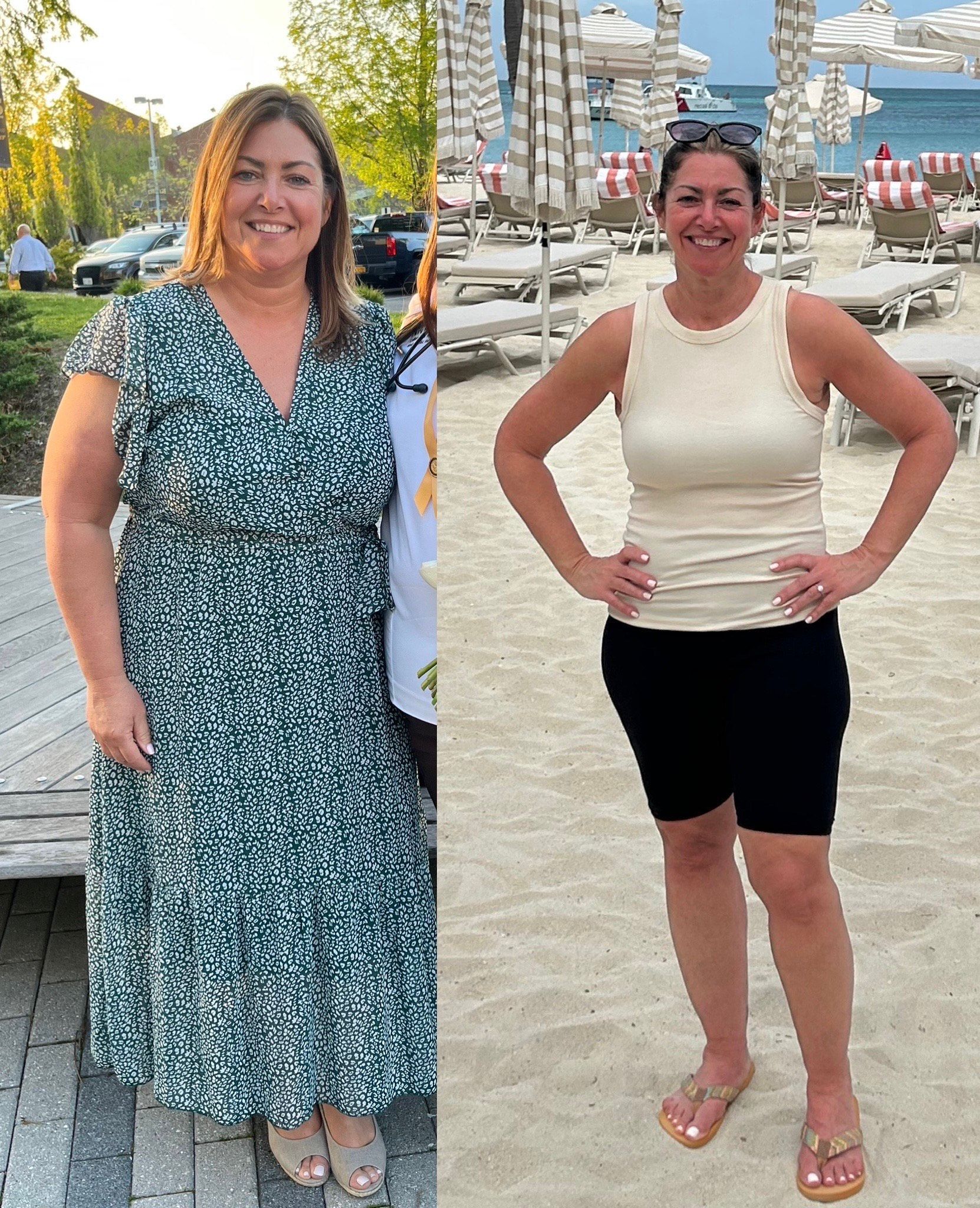 Woman before and after weight loss, standing on a beach. Wearing a green dress and a tank top with shorts.