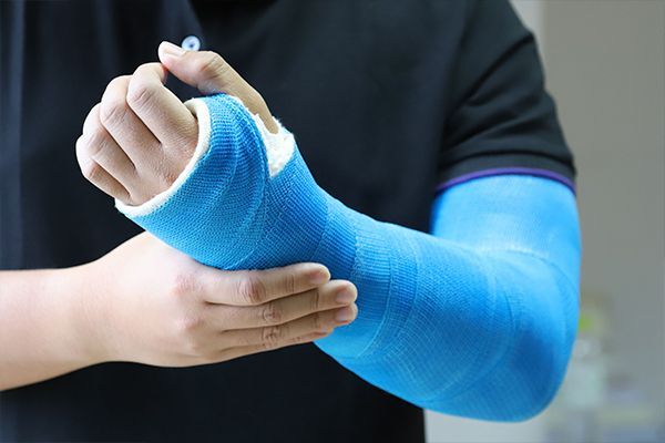 A person with a blue cast on their arm.