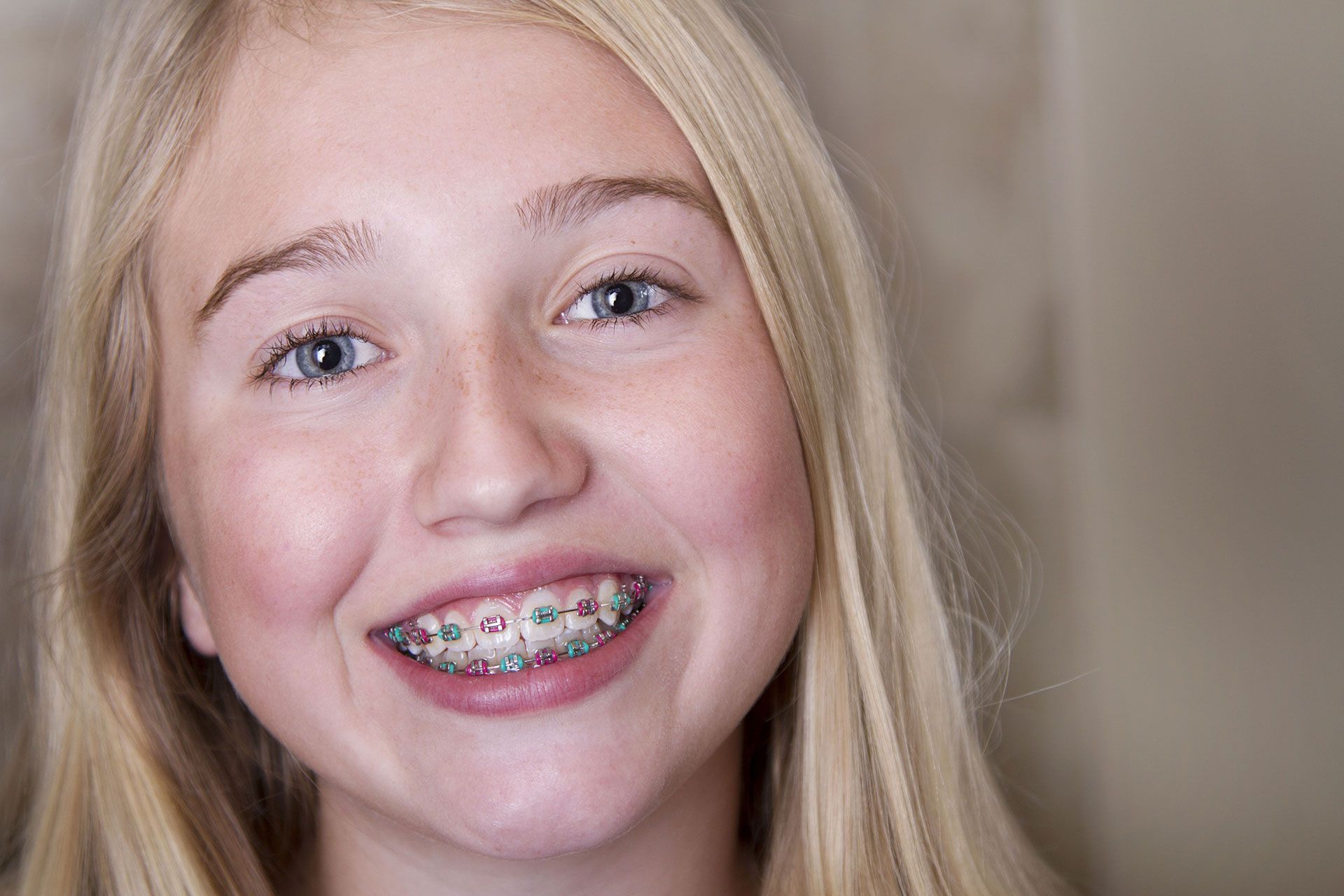 A young girl with braces is smiling for the camera.