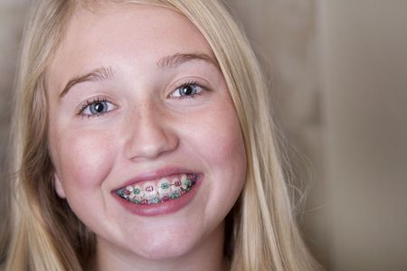 A young girl with braces is smiling for the camera.