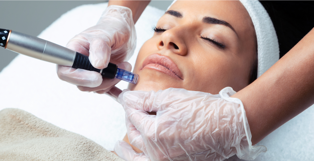 Woman receiving micro-needling treatment on her chin by someone wearing gloves, in a spa setting.