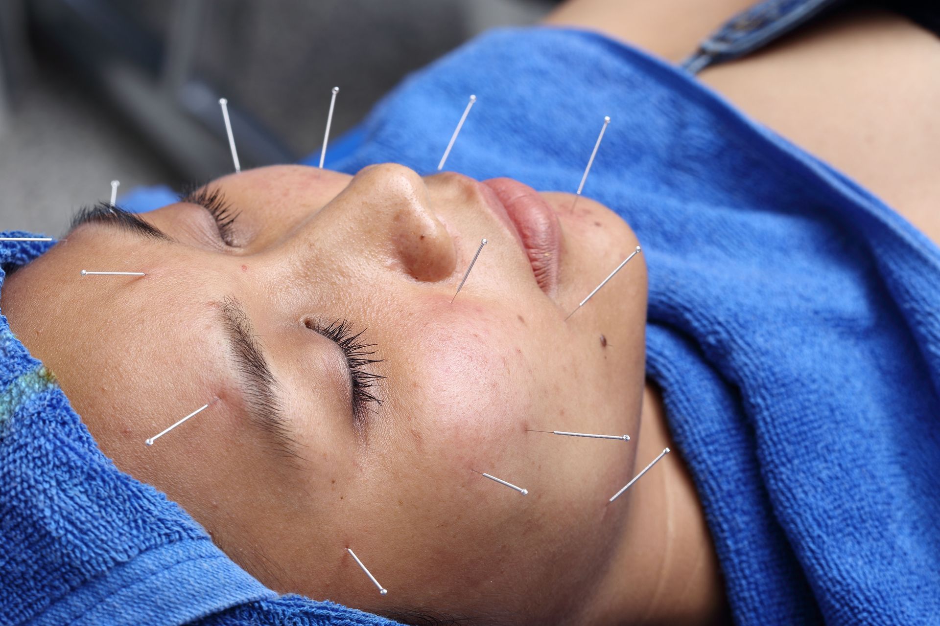 E. W. Natural Healing Acupuncture P.C.
