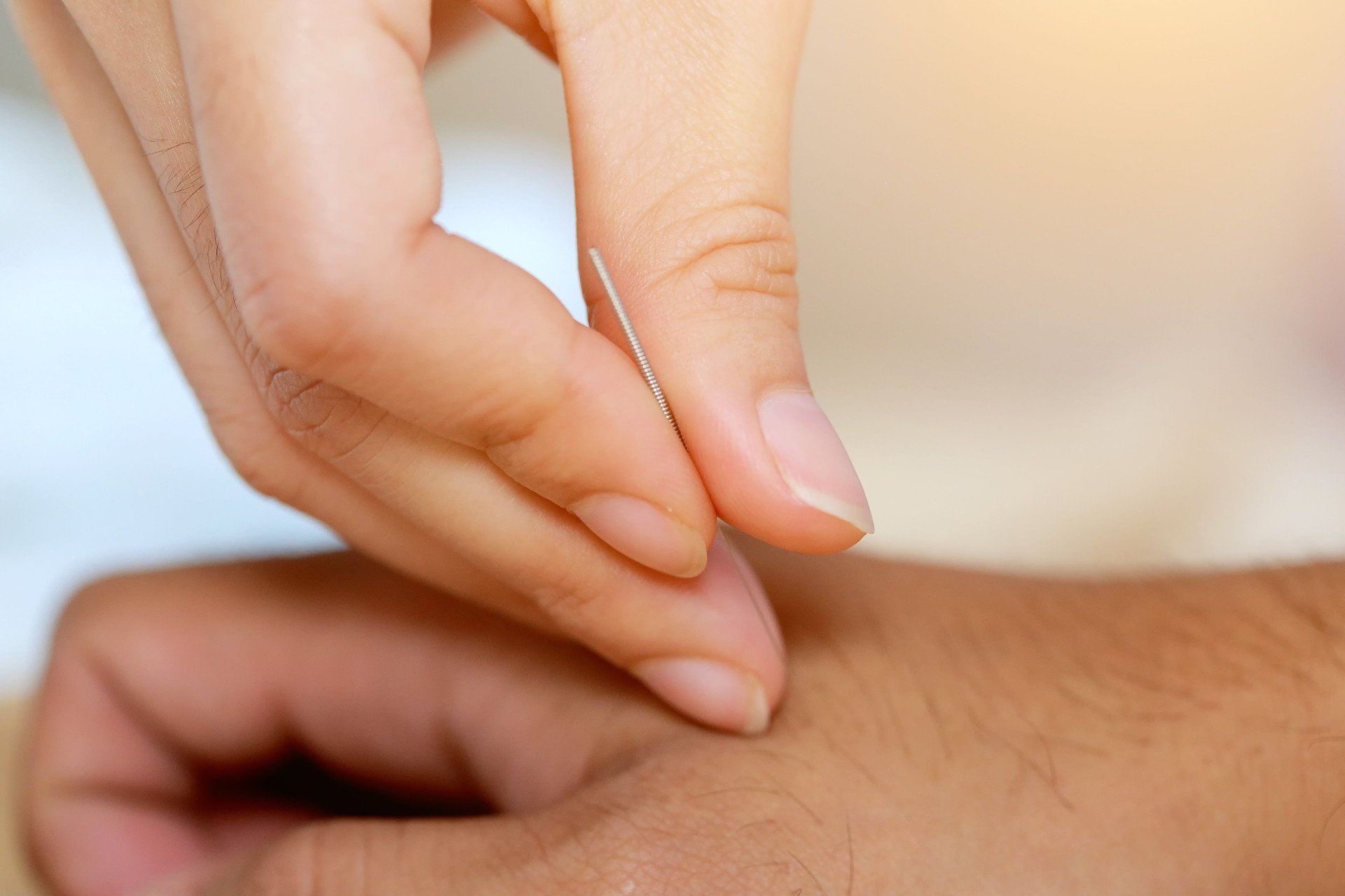 A close-up view of an acupuncturist's fingers placing a fine needle into the skin of a person’s hand.