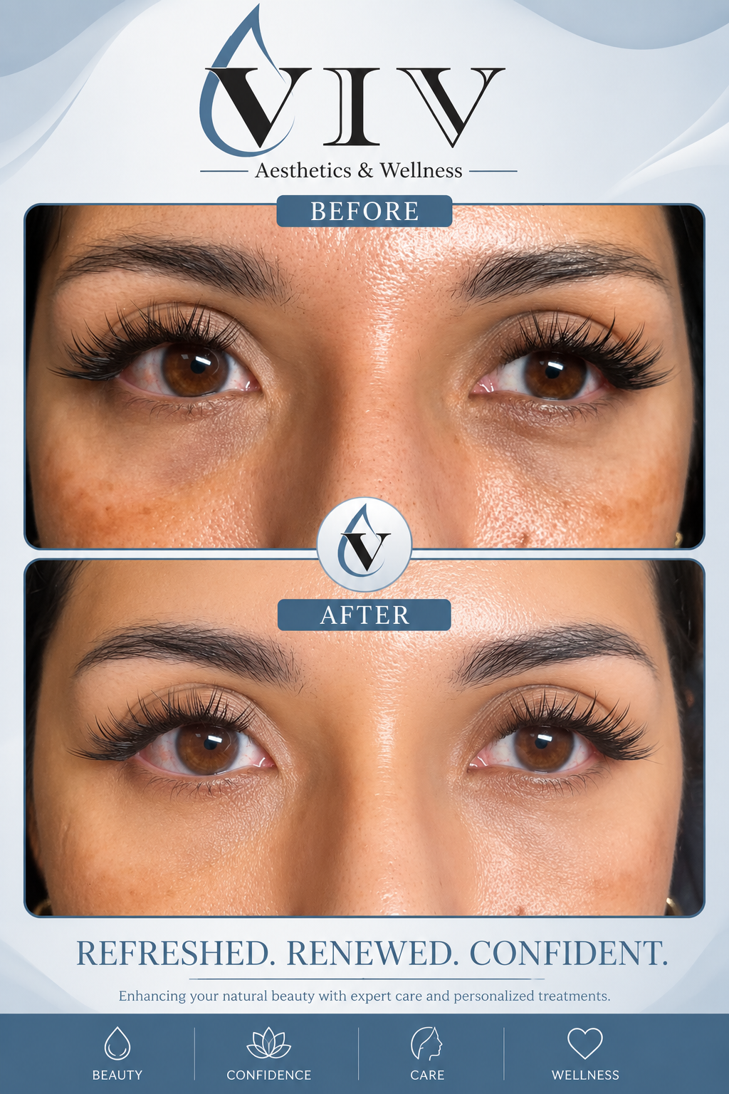 Before and after picture of eyes