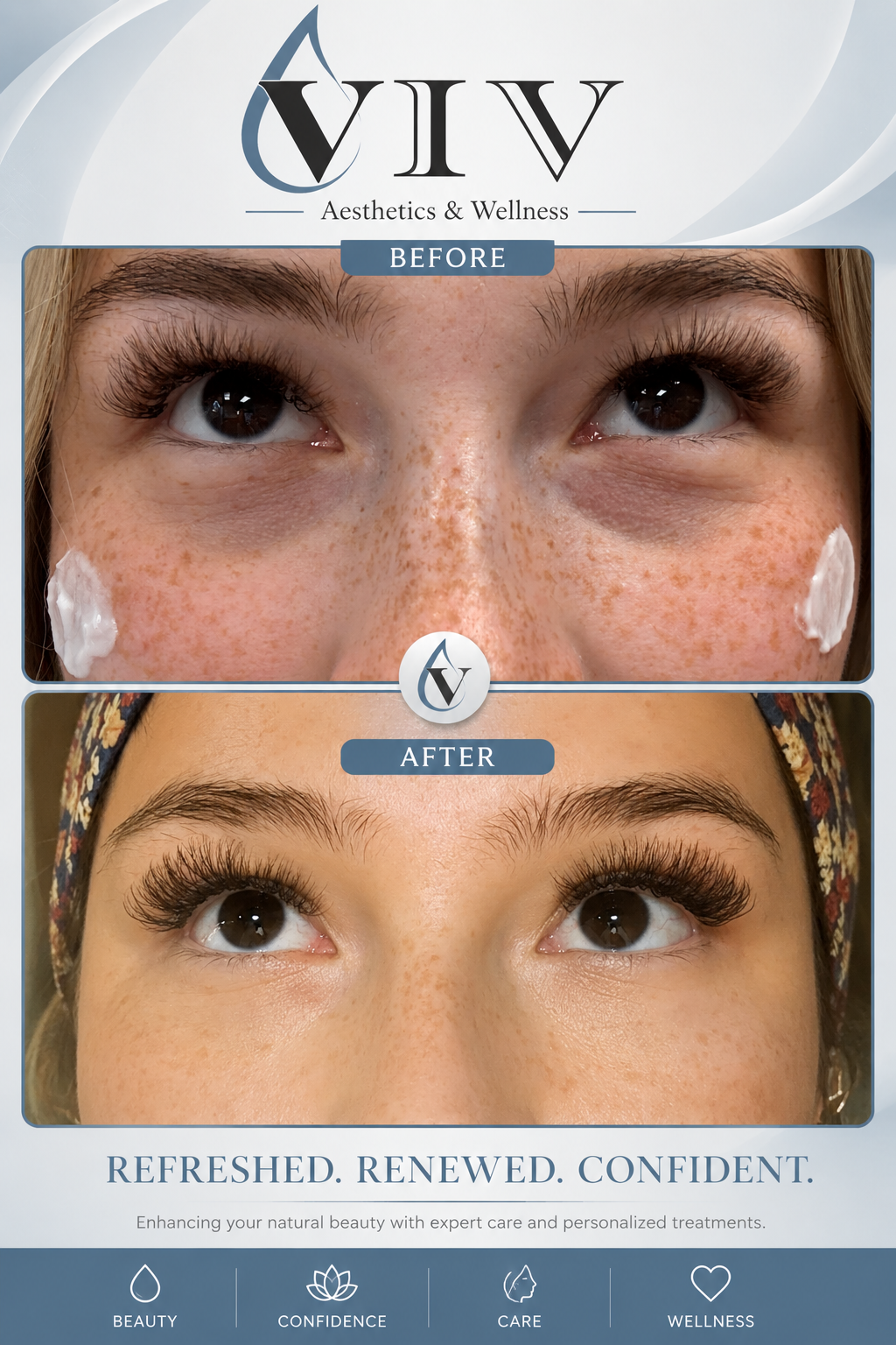 Before and after picture of a freckled face