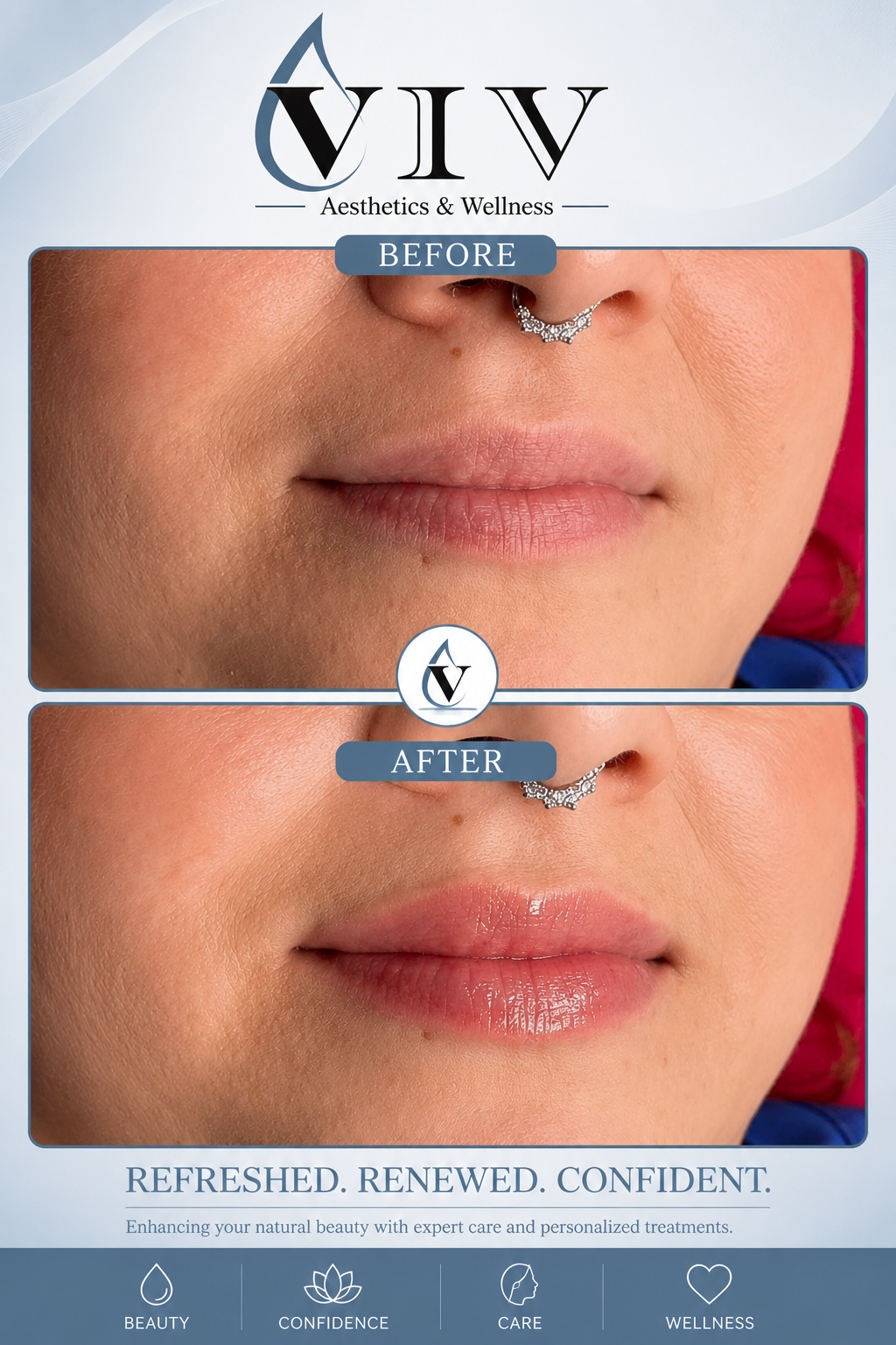 Before and after picture of lips