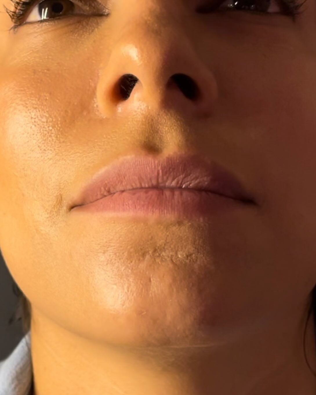 Close-up view of a person’s lower face, highlighting the nose, lips, and chin.