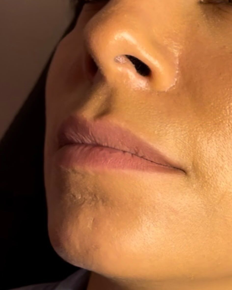 Close-up of a person's lower face, focusing on their mouth and chin in warm lighting.