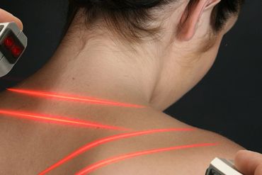 Cold laser therapy service