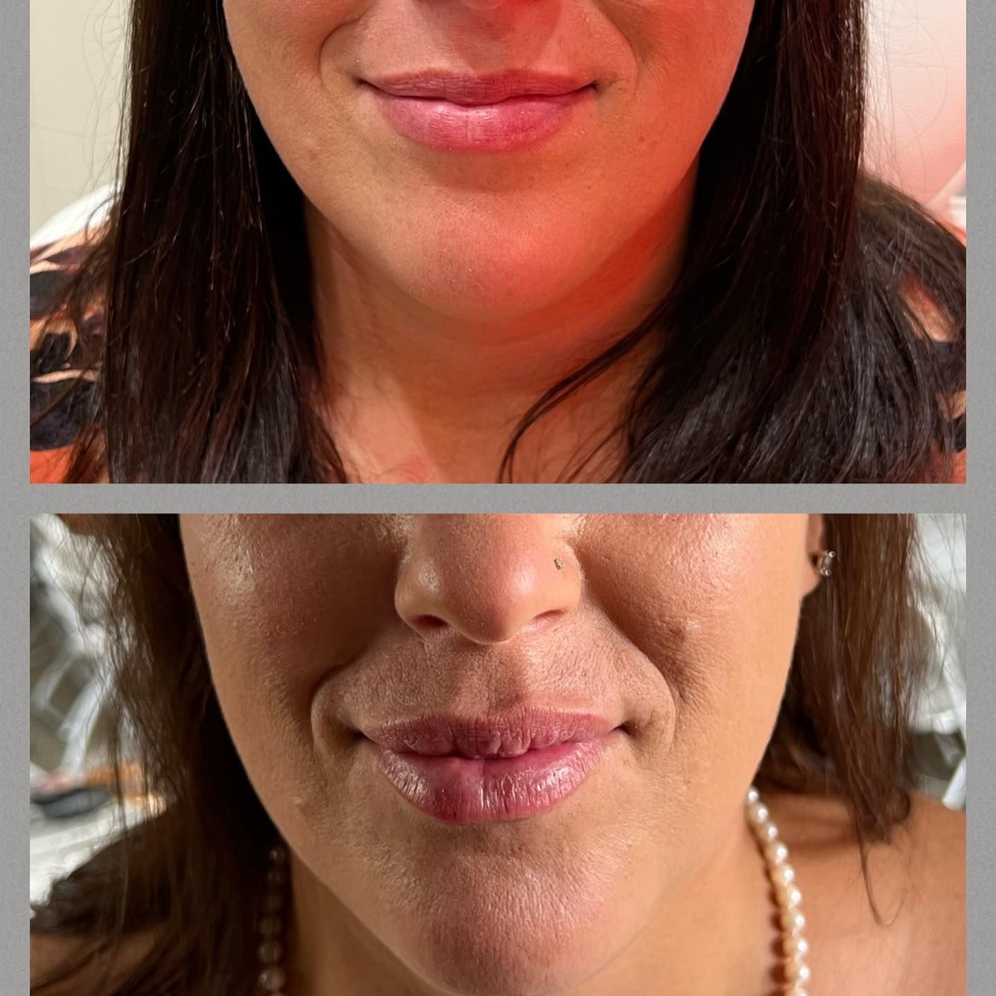 before and after photo