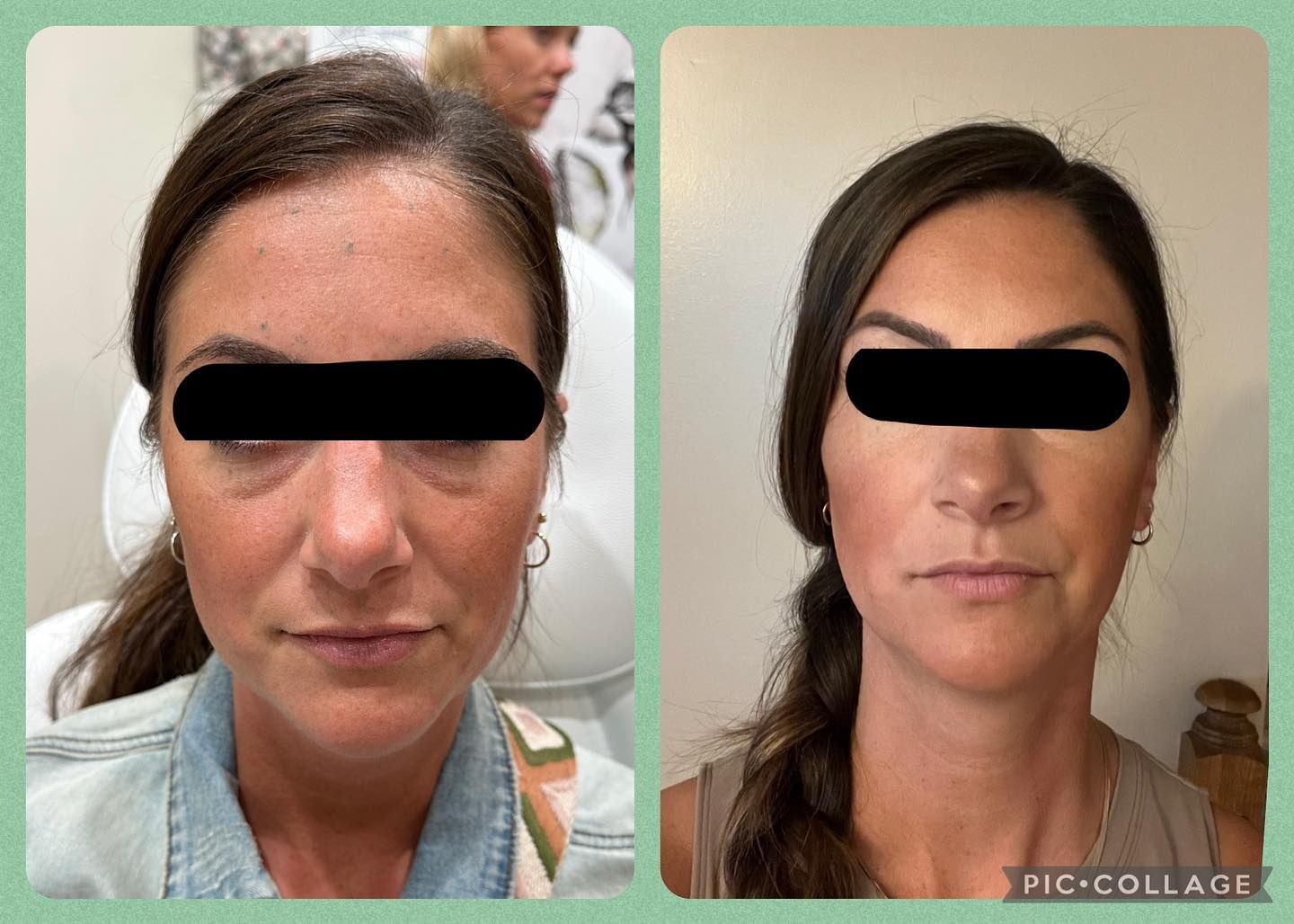 before and after client image