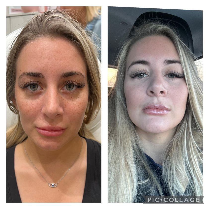 before-and-after images of a procedure