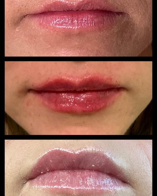 A close up of a woman 's lips before and after applying lip gloss