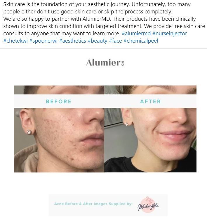 A before and after photo of a man's face.