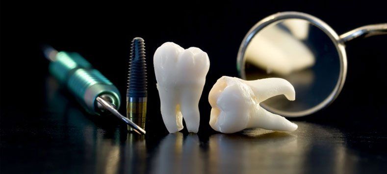 Cosmetic Teeth implants