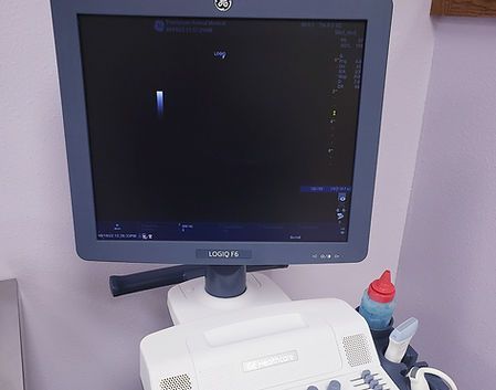 ultrasound