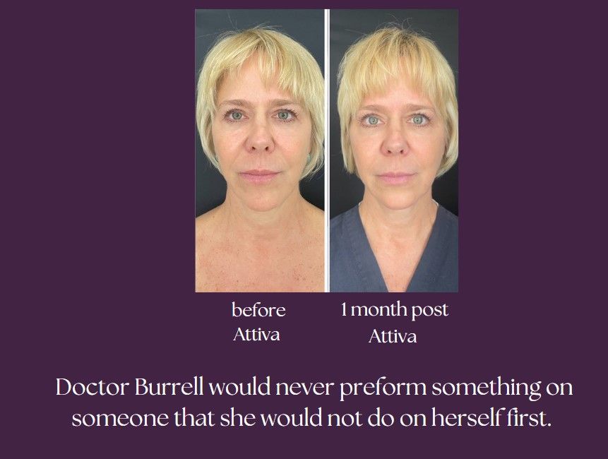 Comparison image showing ATTIVA product before and after.