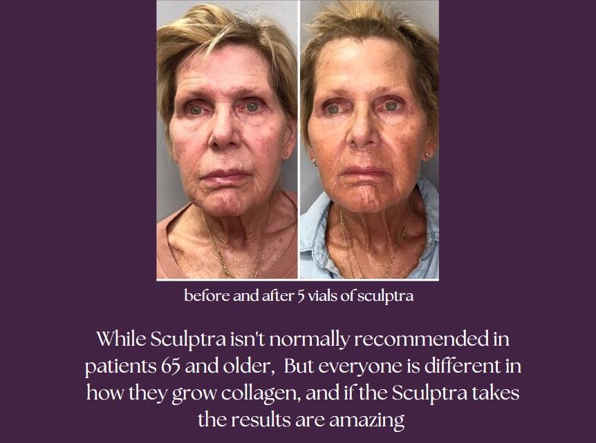 A before and after using the product to the face.