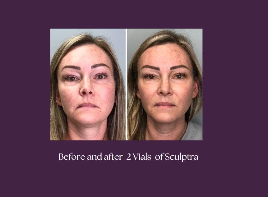 A before and after using the product.