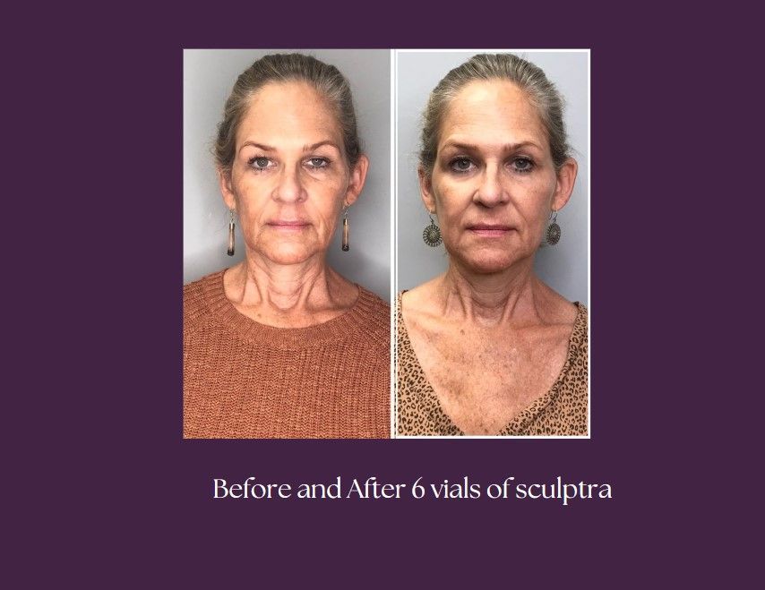 A before and after using the product to the woman face.