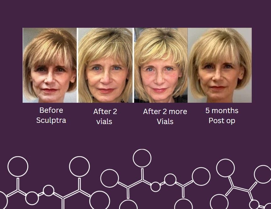 A before and after using our product.