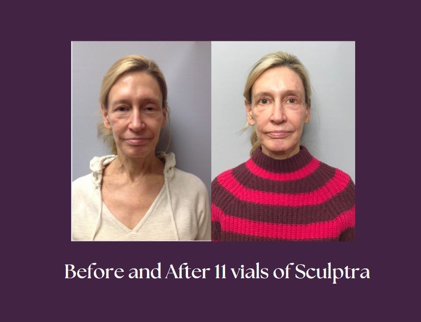 the face of the clients after using the product.