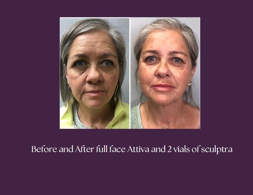 A before and after of the client after using the product.