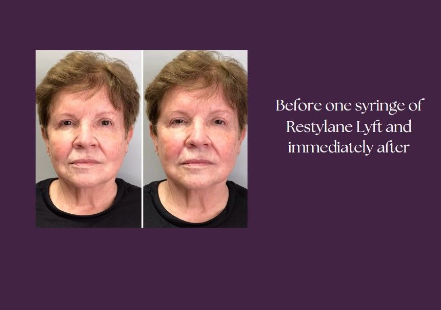 A before and after of the old woman using the product.