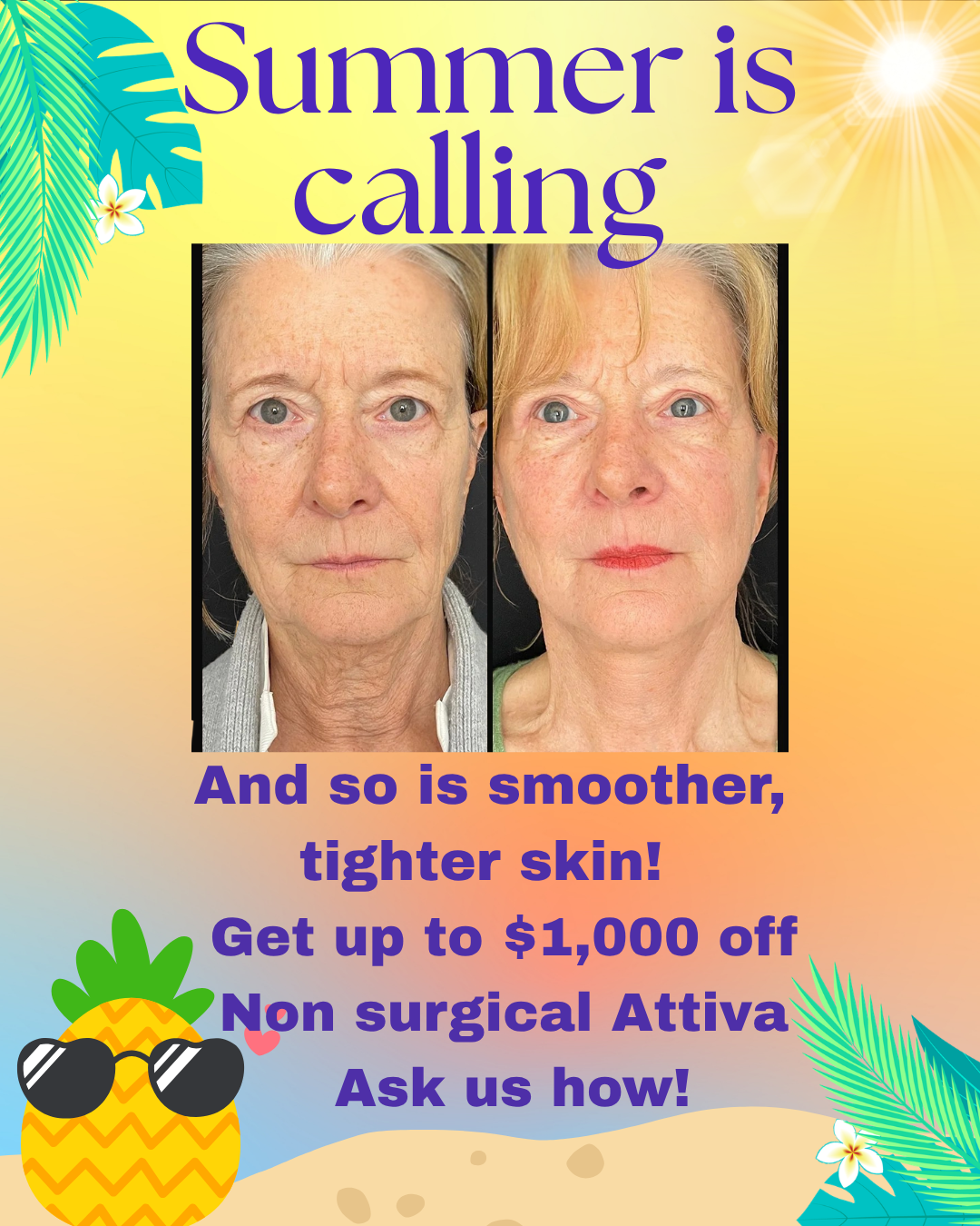 Summer skin-care ad with before-and-after face photos and text about smoother, tighter skin and $1,000 off Attiva