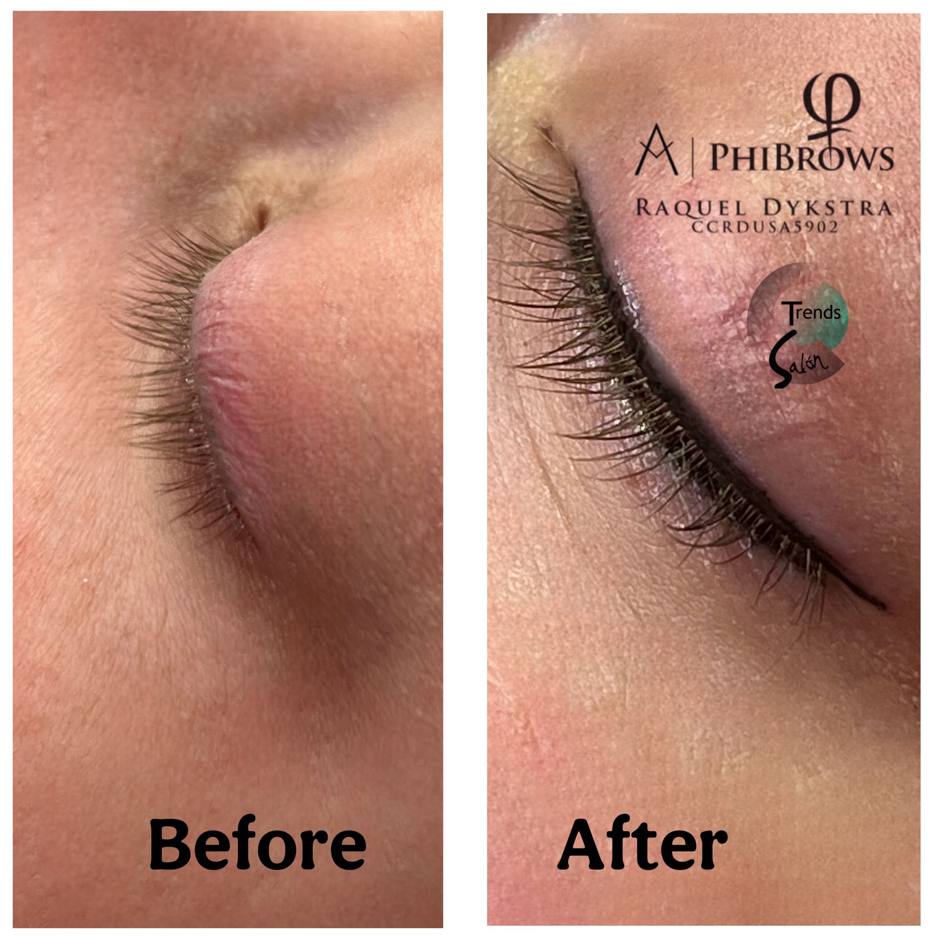 A picture of an image holder on a white background.