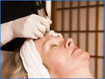 Lady taking skin teratment