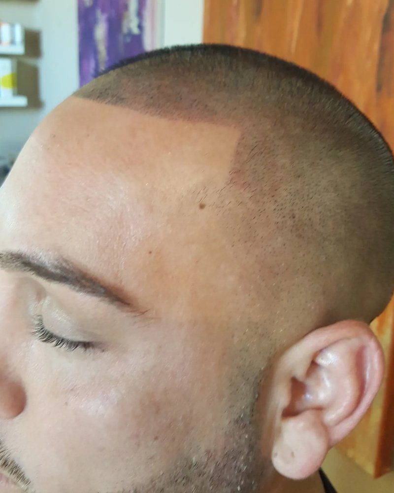 Scalp micropigmentation #19