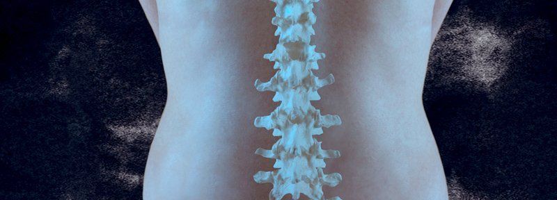 Epidurals