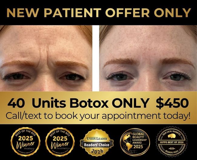 Elite spa June specials ad: 20% off facials, $75 off filler, with model and gold/white design